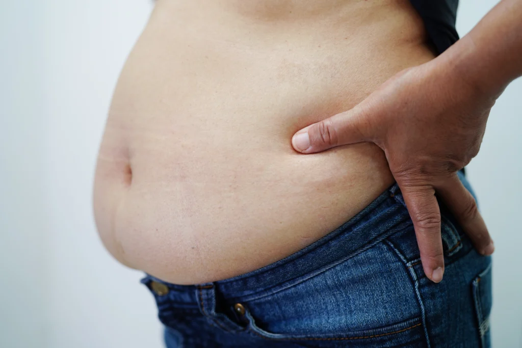 Weight Loss Treatments for Obesity In Cape Town